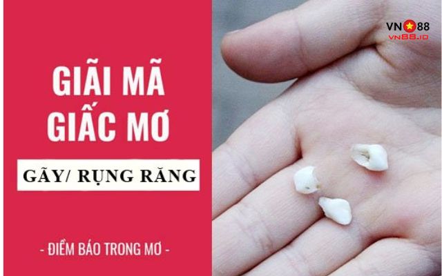 Muôn vàn giấc mơ rụng răng